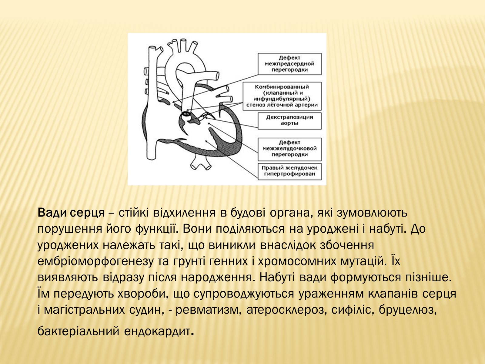 Презентація на тему «Захворювання серцево-судинної системи» (варіант 3) - Слайд #9 Презентація на тему «Захворювання серцево-судинної системи» (варіант 3) - Слайд #9