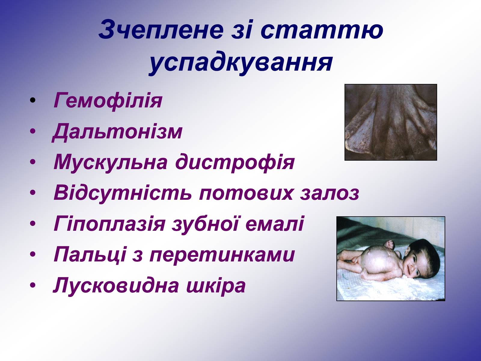 Презентація на тему «Генетика людини» (варіант 1) - Слайд #19 Презентація на тему «Генетика людини» (варіант 1) - Слайд #19