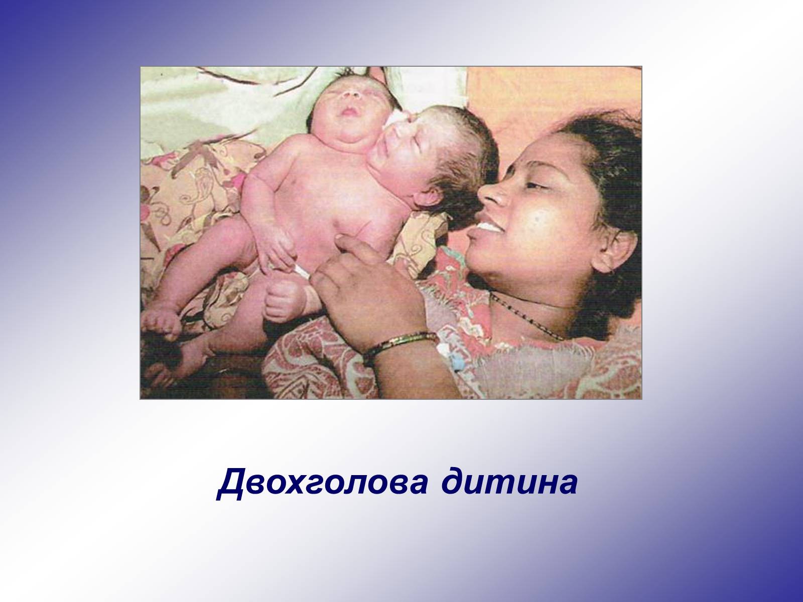 Презентація на тему «Генетика людини» (варіант 1) - Слайд #75 Презентація на тему «Генетика людини» (варіант 1) - Слайд #75
