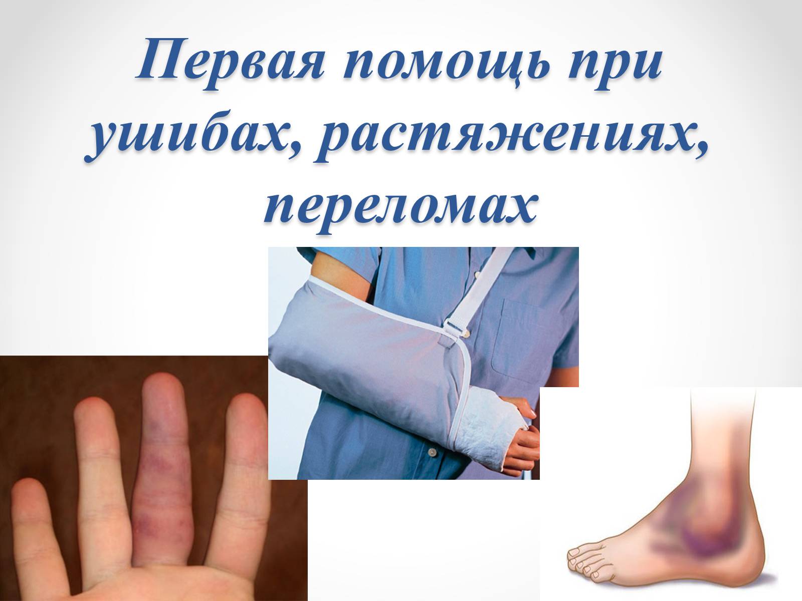 Презентація на тему «Первая помощь при ушибах, растяжениях, переломах» - Слайд #1 Презентація на тему «Первая помощь при ушибах, растяжениях, переломах» - Слайд #1