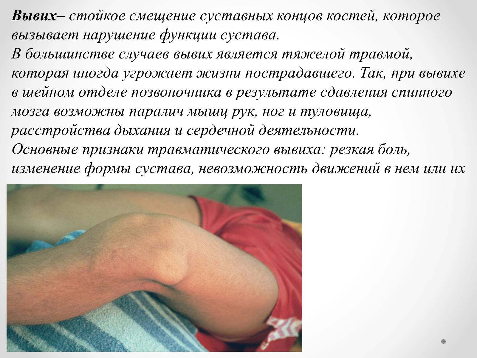 Презентація на тему «Первая помощь при ушибах, растяжениях, переломах» - Слайд #6 Презентація на тему «Первая помощь при ушибах, растяжениях, переломах» - Слайд #6