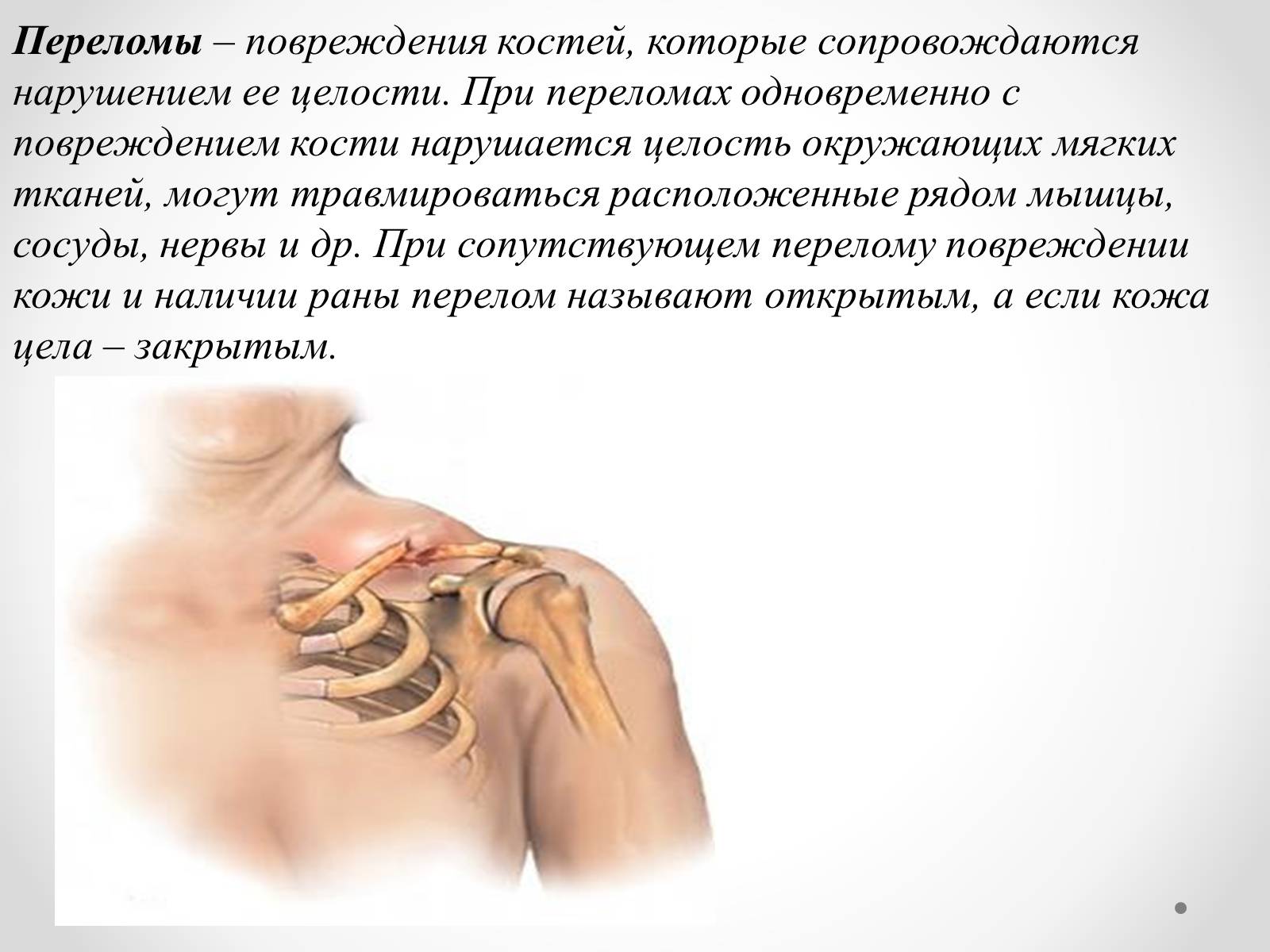 Презентація на тему «Первая помощь при ушибах, растяжениях, переломах» - Слайд #8 Презентація на тему «Первая помощь при ушибах, растяжениях, переломах» - Слайд #8