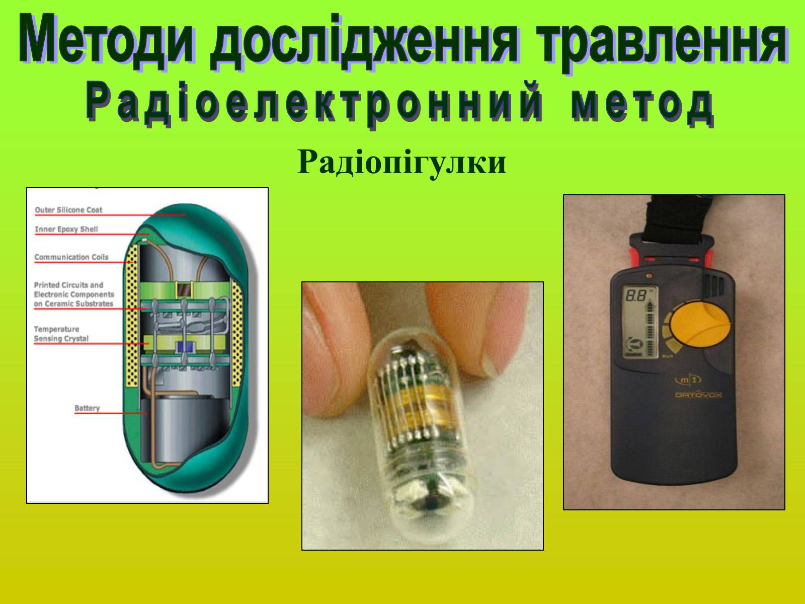 Презентація на тему «Методи дослідження органів травлення» - Слайд #10 Презентація на тему «Методи дослідження органів травлення» - Слайд #10