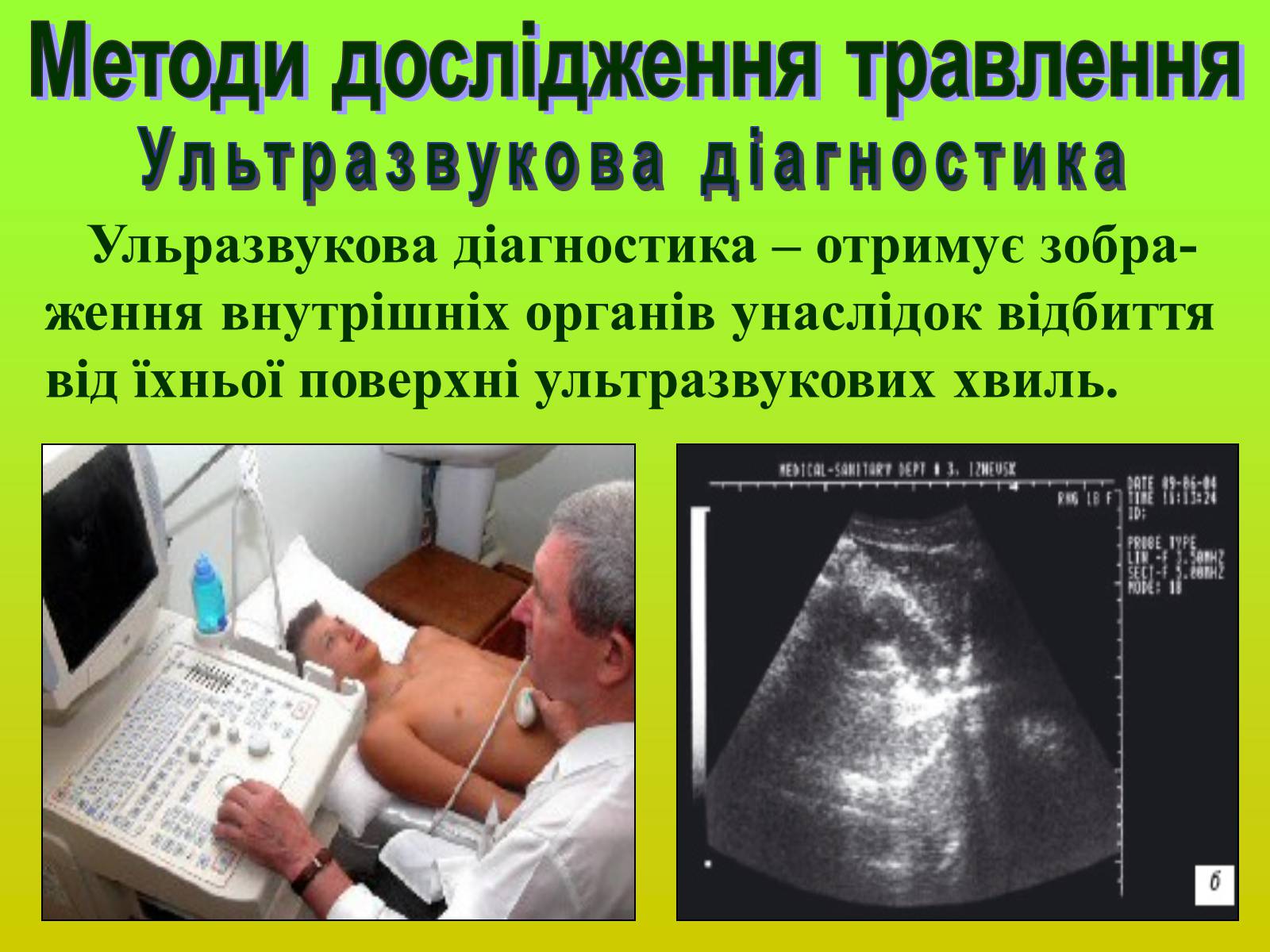 Презентація на тему «Методи дослідження органів травлення» - Слайд #11 Презентація на тему «Методи дослідження органів травлення» - Слайд #11