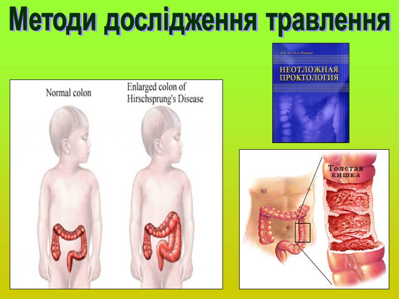 Презентація на тему «Методи дослідження органів травлення» - Слайд #16 Презентація на тему «Методи дослідження органів травлення» - Слайд #16