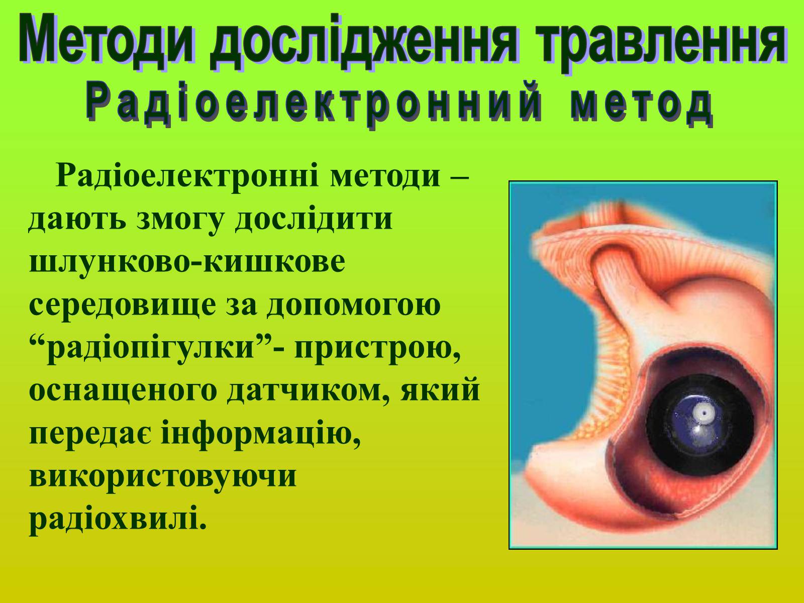 Презентація на тему «Методи дослідження органів травлення» - Слайд #9 Презентація на тему «Методи дослідження органів травлення» - Слайд #9