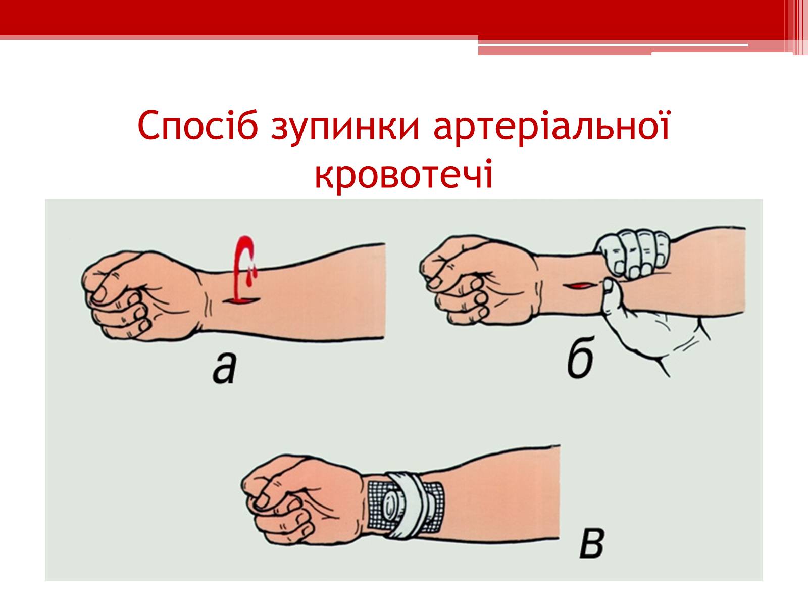 Презентація на тему «Перша допомога при кровотечах» (варіант 1) - Слайд #10 Презентація на тему «Перша допомога при кровотечах» (варіант 1) - Слайд #10