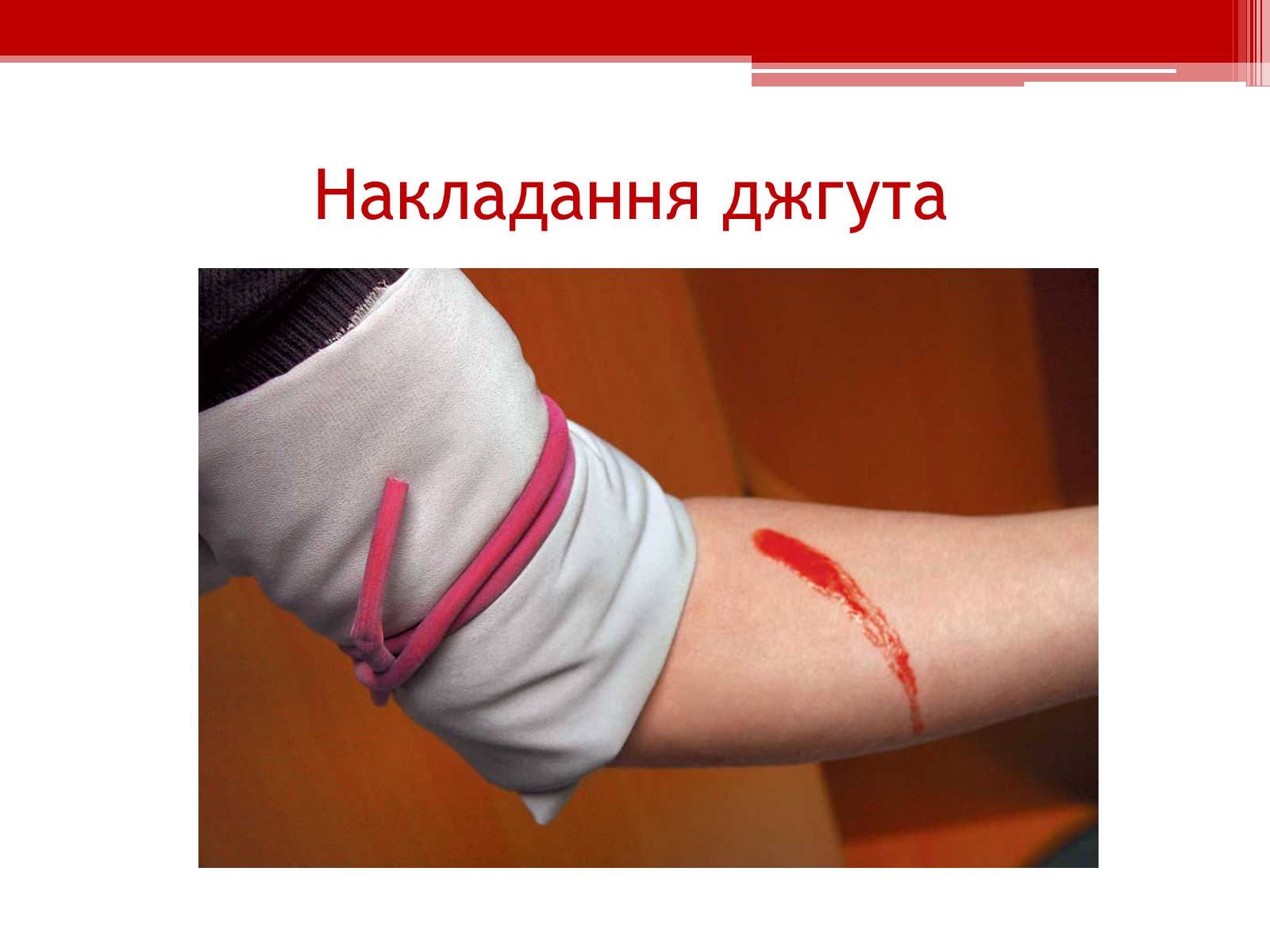 Презентація на тему «Перша допомога при кровотечах» (варіант 1) - Слайд #14 Презентація на тему «Перша допомога при кровотечах» (варіант 1) - Слайд #14