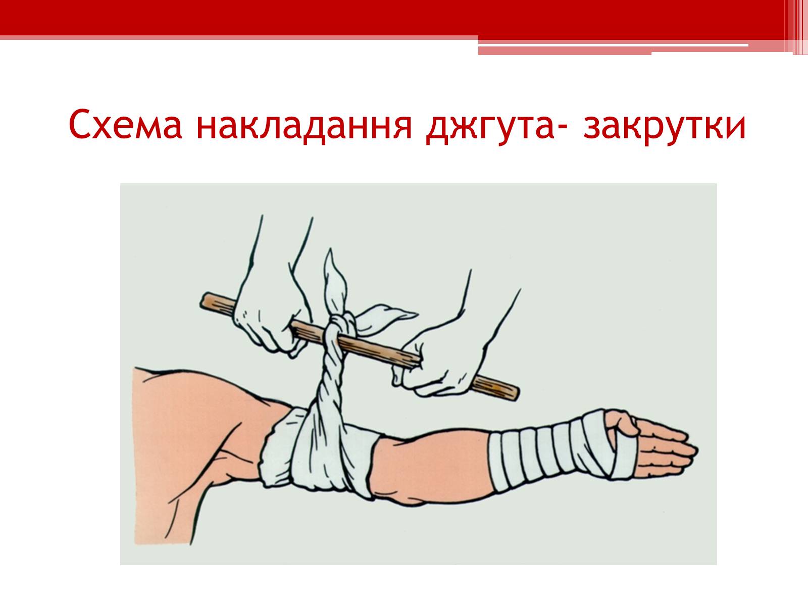 Презентація на тему «Перша допомога при кровотечах» (варіант 1) - Слайд #15 Презентація на тему «Перша допомога при кровотечах» (варіант 1) - Слайд #15