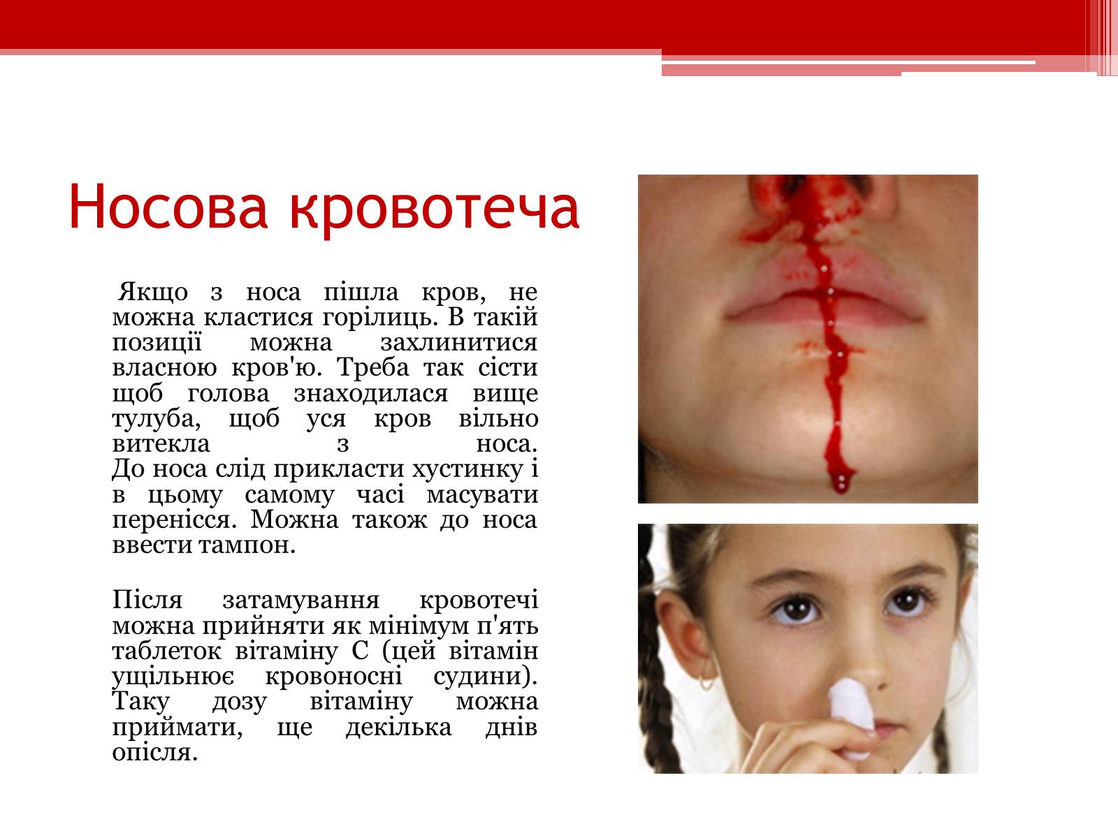 Презентація на тему «Перша допомога при кровотечах» (варіант 1) - Слайд #16 Презентація на тему «Перша допомога при кровотечах» (варіант 1) - Слайд #16