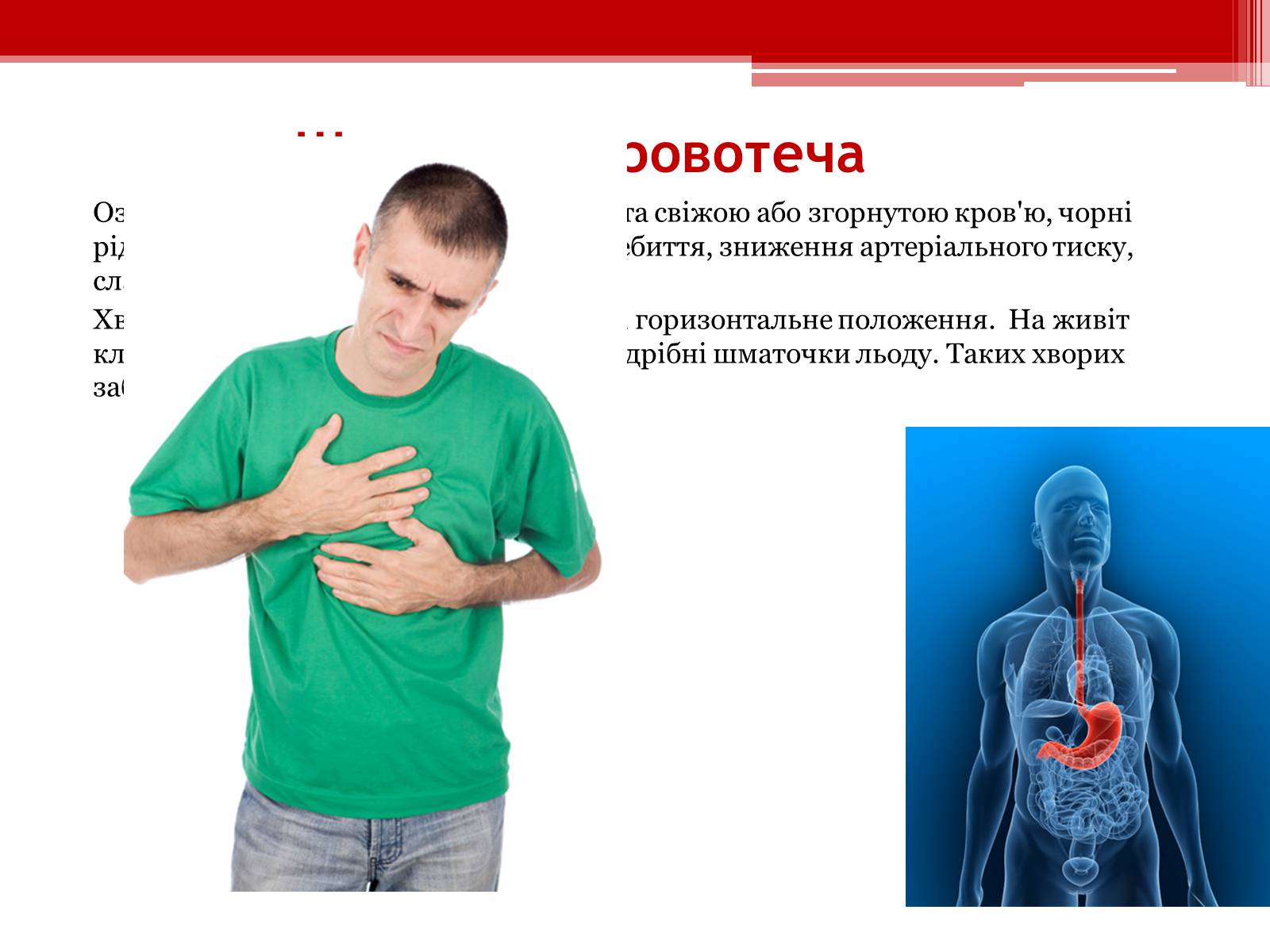 Презентація на тему «Перша допомога при кровотечах» (варіант 1) - Слайд #17 Презентація на тему «Перша допомога при кровотечах» (варіант 1) - Слайд #17