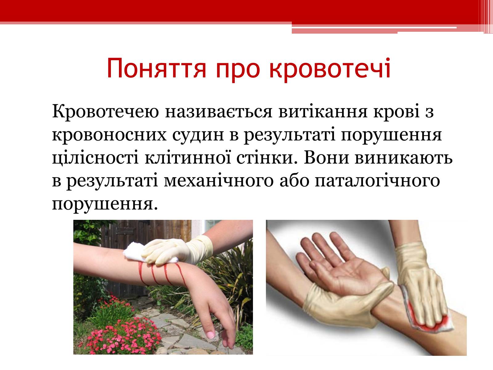 Презентація на тему «Перша допомога при кровотечах» (варіант 1) - Слайд #2 Презентація на тему «Перша допомога при кровотечах» (варіант 1) - Слайд #2