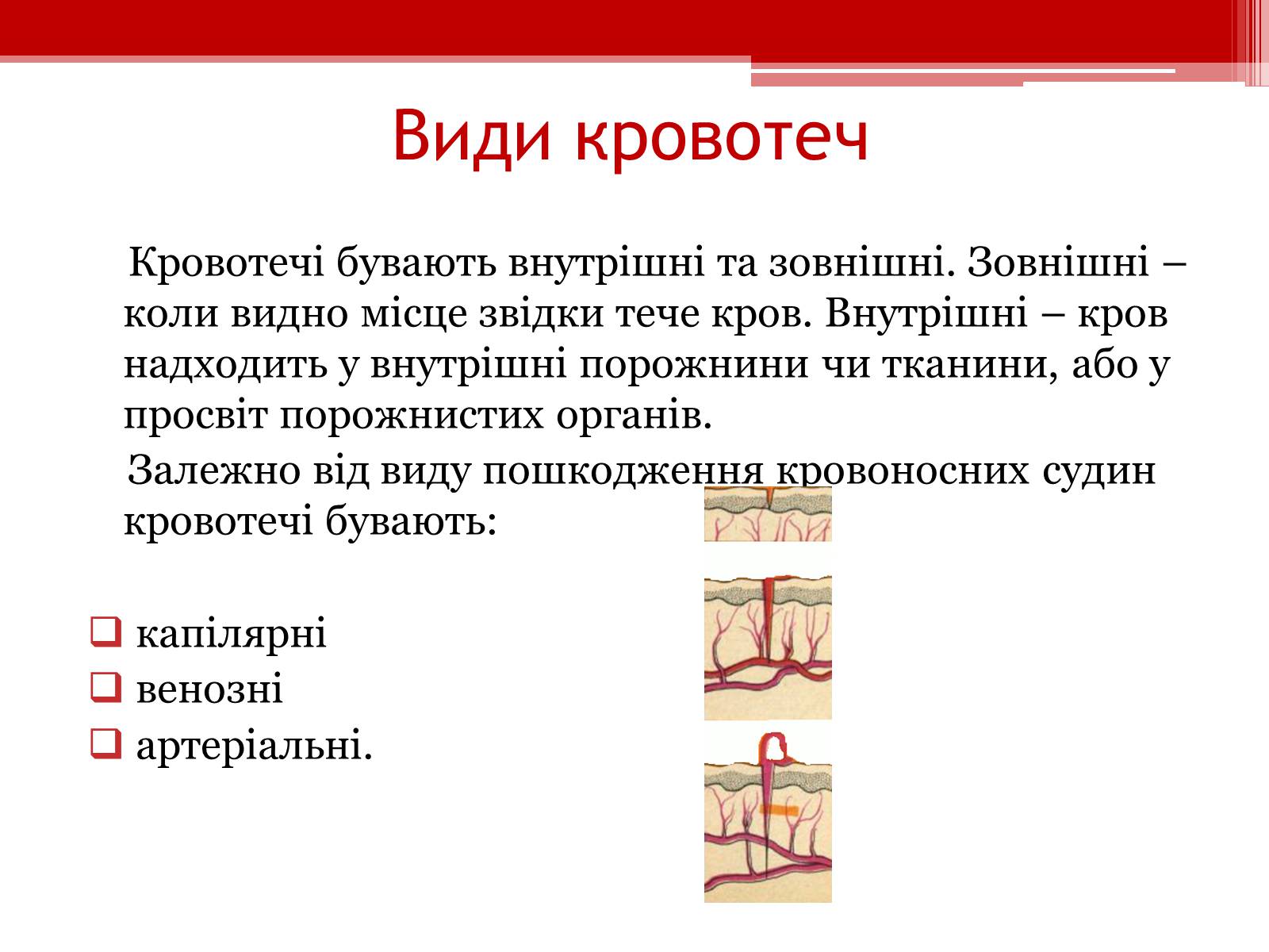 Презентація на тему «Перша допомога при кровотечах» (варіант 1) - Слайд #4 Презентація на тему «Перша допомога при кровотечах» (варіант 1) - Слайд #4