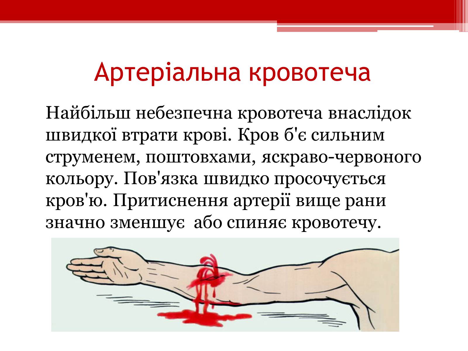 Презентація на тему «Перша допомога при кровотечах» (варіант 1) - Слайд #8 Презентація на тему «Перша допомога при кровотечах» (варіант 1) - Слайд #8