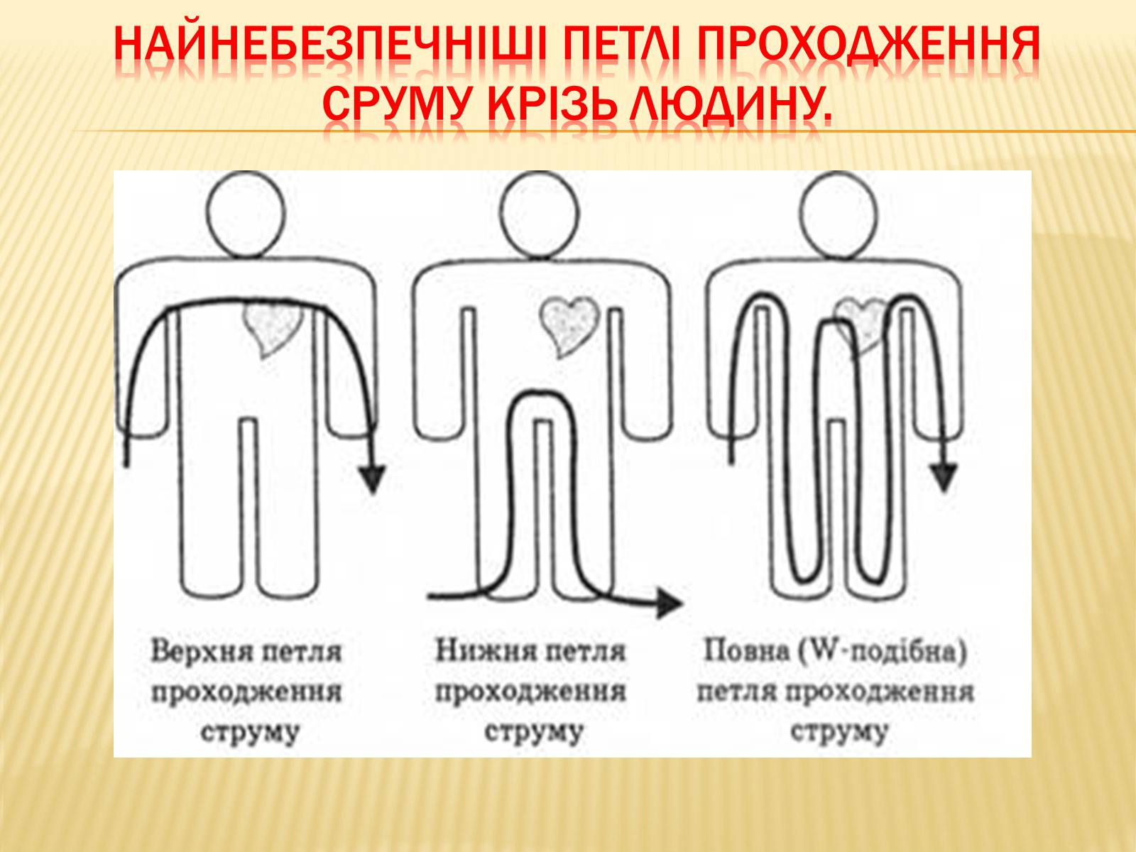 Презентація на тему «Ураження електричним струмом» (варіант 1) - Слайд #7