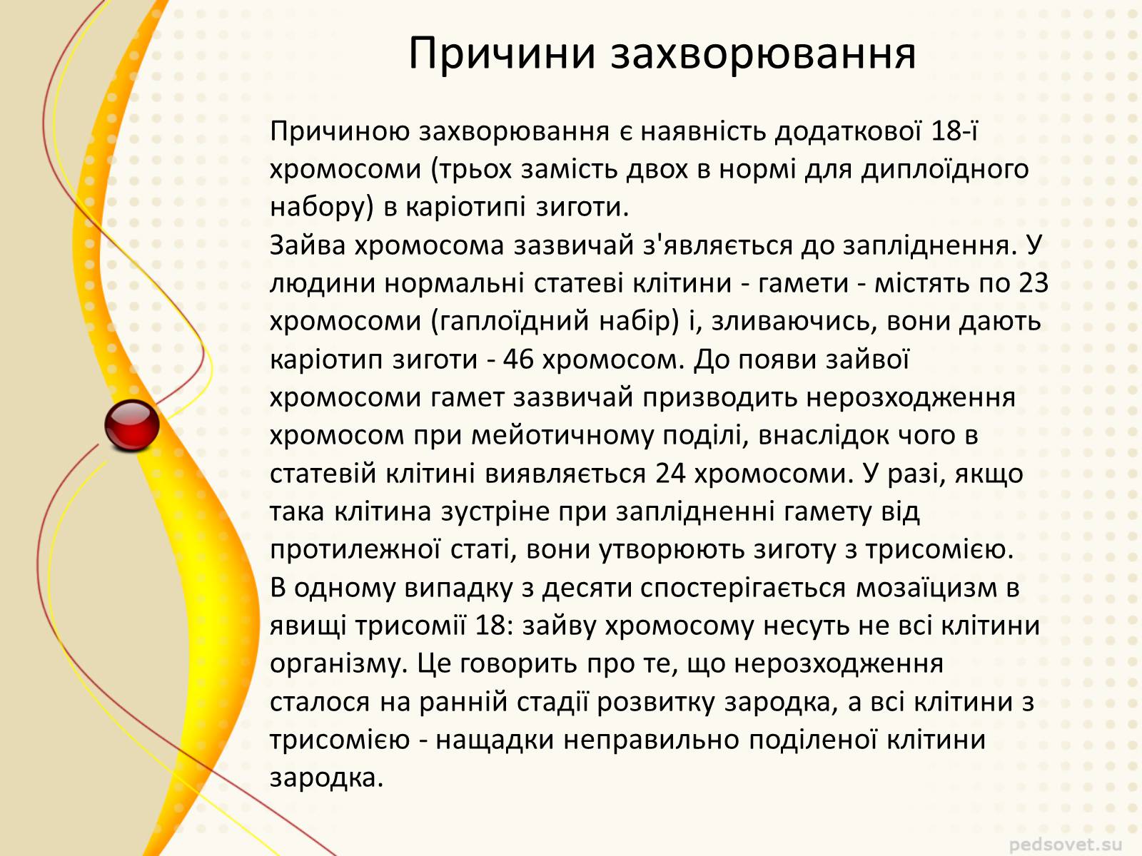 Презентація на тему «Синдром Эдвардса» - Слайд #3 Презентація на тему «Синдром Эдвардса» - Слайд #3