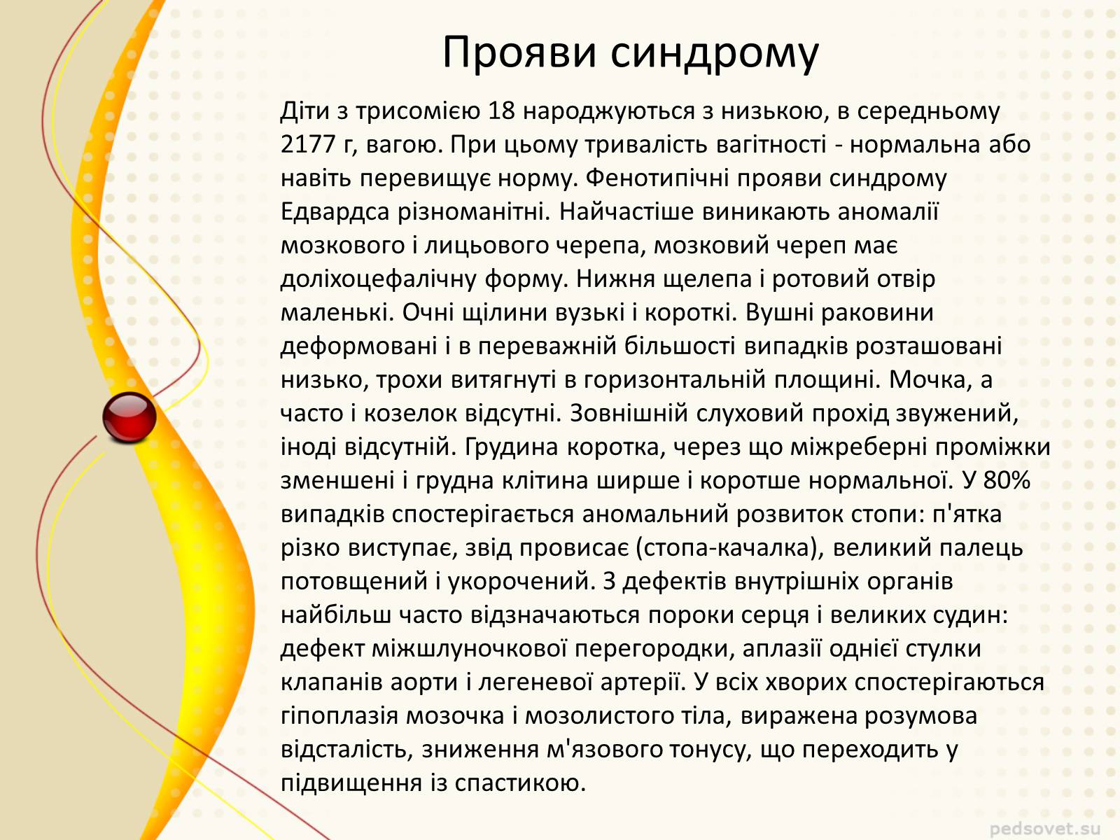 Презентація на тему «Синдром Эдвардса» - Слайд #5 Презентація на тему «Синдром Эдвардса» - Слайд #5