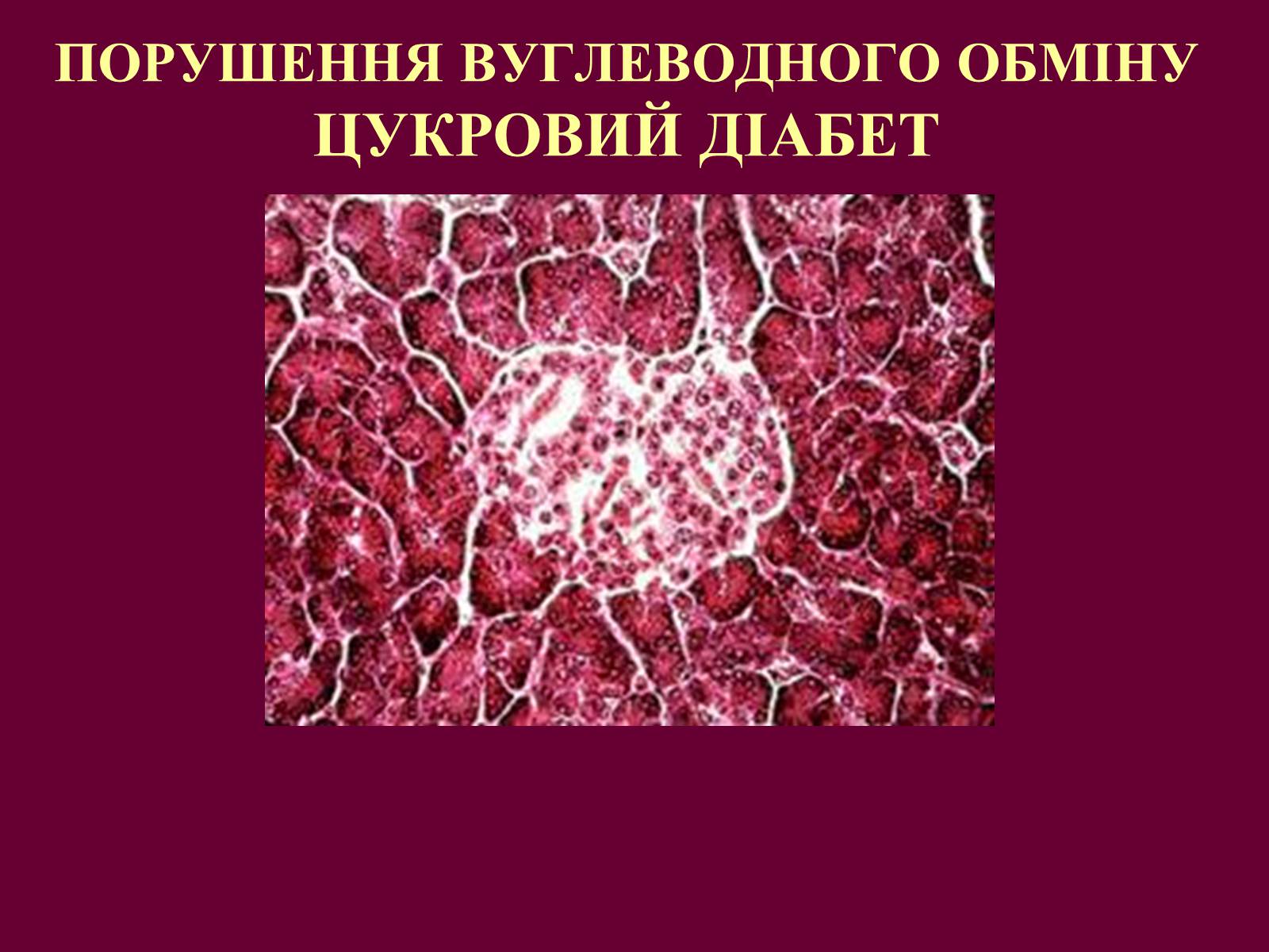 Презентація на тему «Цукровий діабет» - Слайд #1 Презентація на тему «Цукровий діабет» - Слайд #1