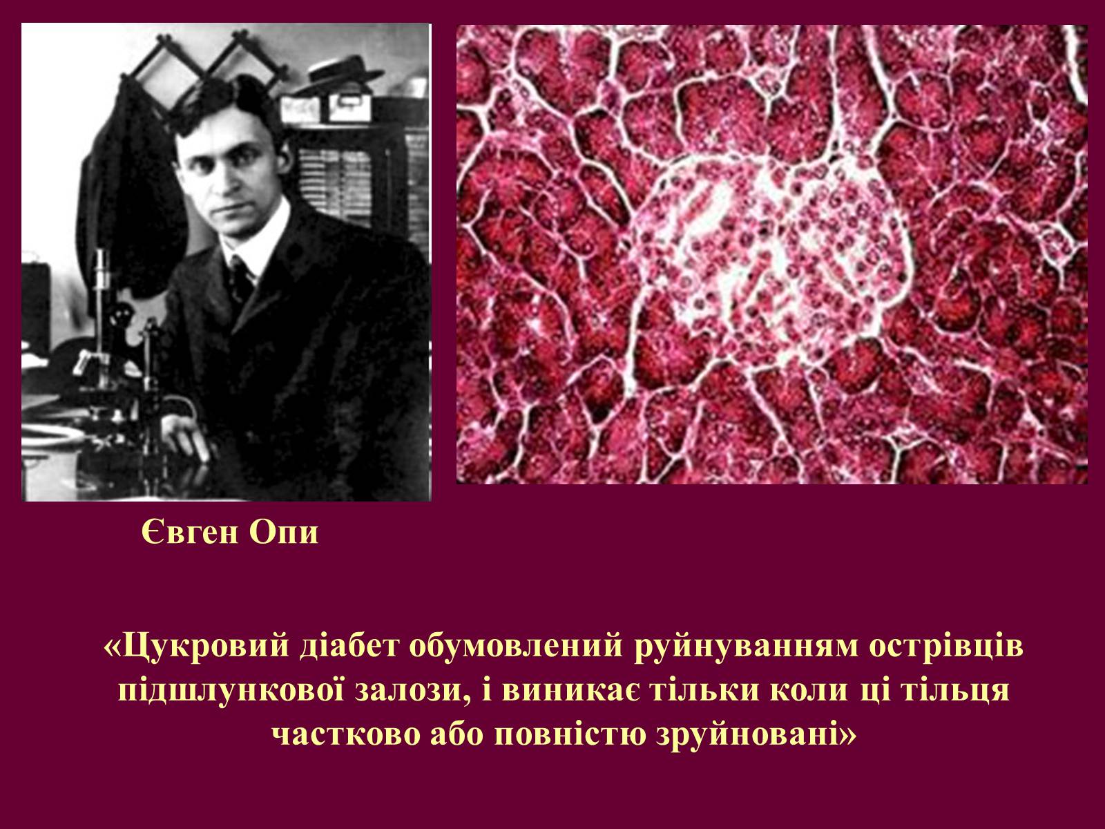 Презентація на тему «Цукровий діабет» - Слайд #5 Презентація на тему «Цукровий діабет» - Слайд #5