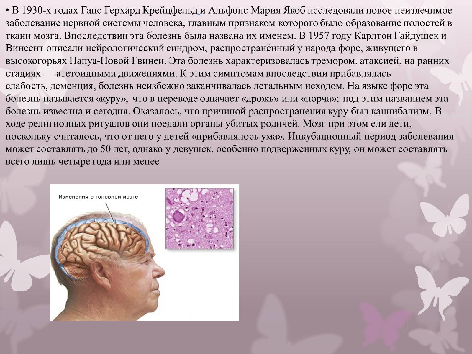 Презентація на тему «Прионы» - Слайд #5 Презентація на тему «Прионы» - Слайд #5