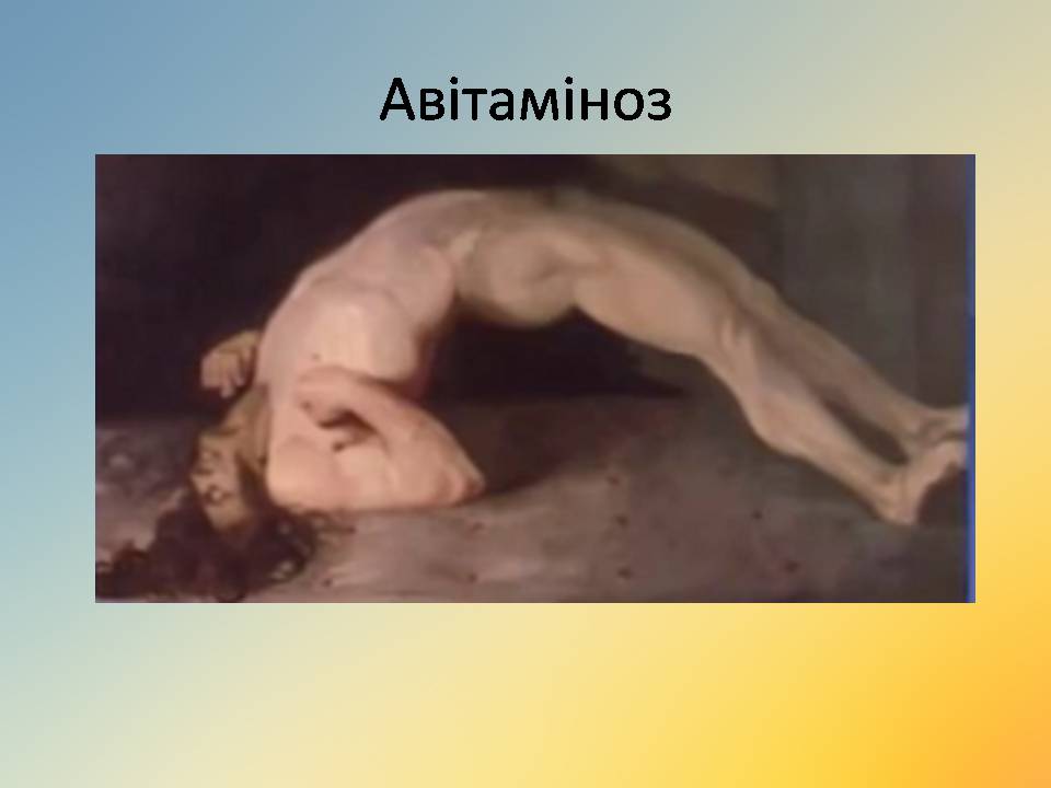 Презентація на тему «Вітаміни» (варіант 18) - Слайд #36 Презентація на тему «Вітаміни» (варіант 18) - Слайд #36