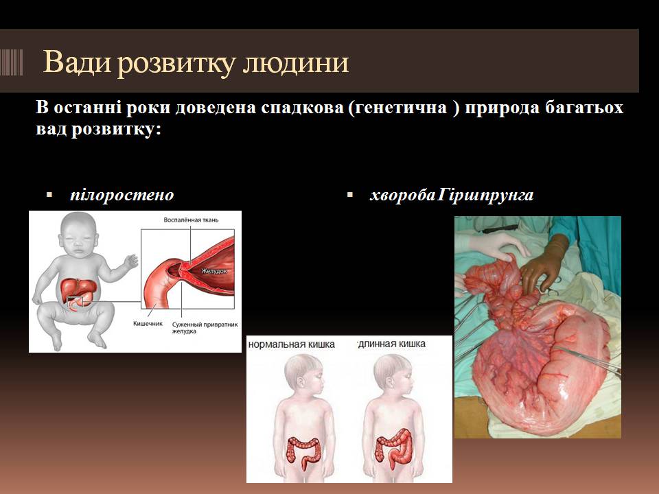 Презентація на тему «Гомеостаз ембріонального розвитку» - Слайд #10 Презентація на тему «Гомеостаз ембріонального розвитку» - Слайд #10