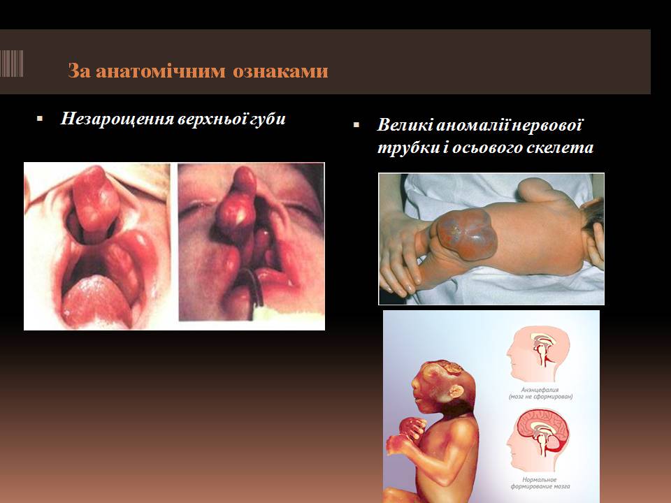 Презентація на тему «Гомеостаз ембріонального розвитку» - Слайд #13 Презентація на тему «Гомеостаз ембріонального розвитку» - Слайд #13