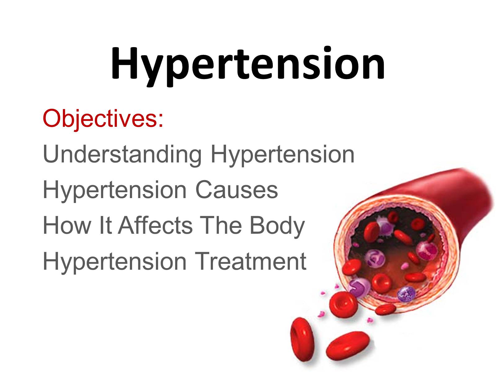 Презентація на тему «Hypertension» - Слайд #1 Презентація на тему «Hypertension» - Слайд #1
