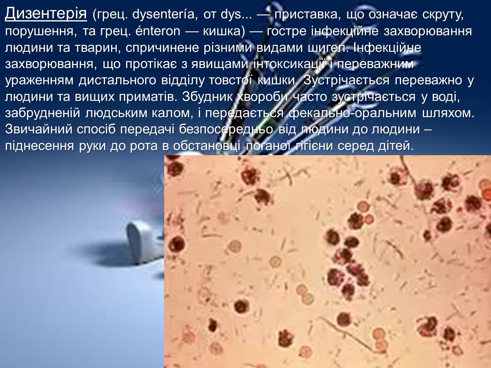 Презентація на тему «Інфекції» (варіант 1) - Слайд #15 Презентація на тему «Інфекції» (варіант 1) - Слайд #15
