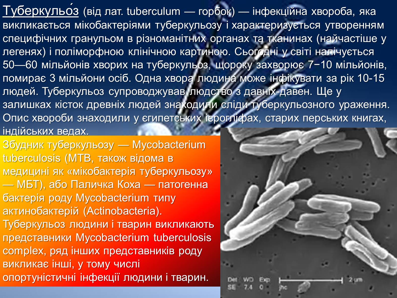 Презентація на тему «Інфекції» (варіант 1) - Слайд #20 Презентація на тему «Інфекції» (варіант 1) - Слайд #20
