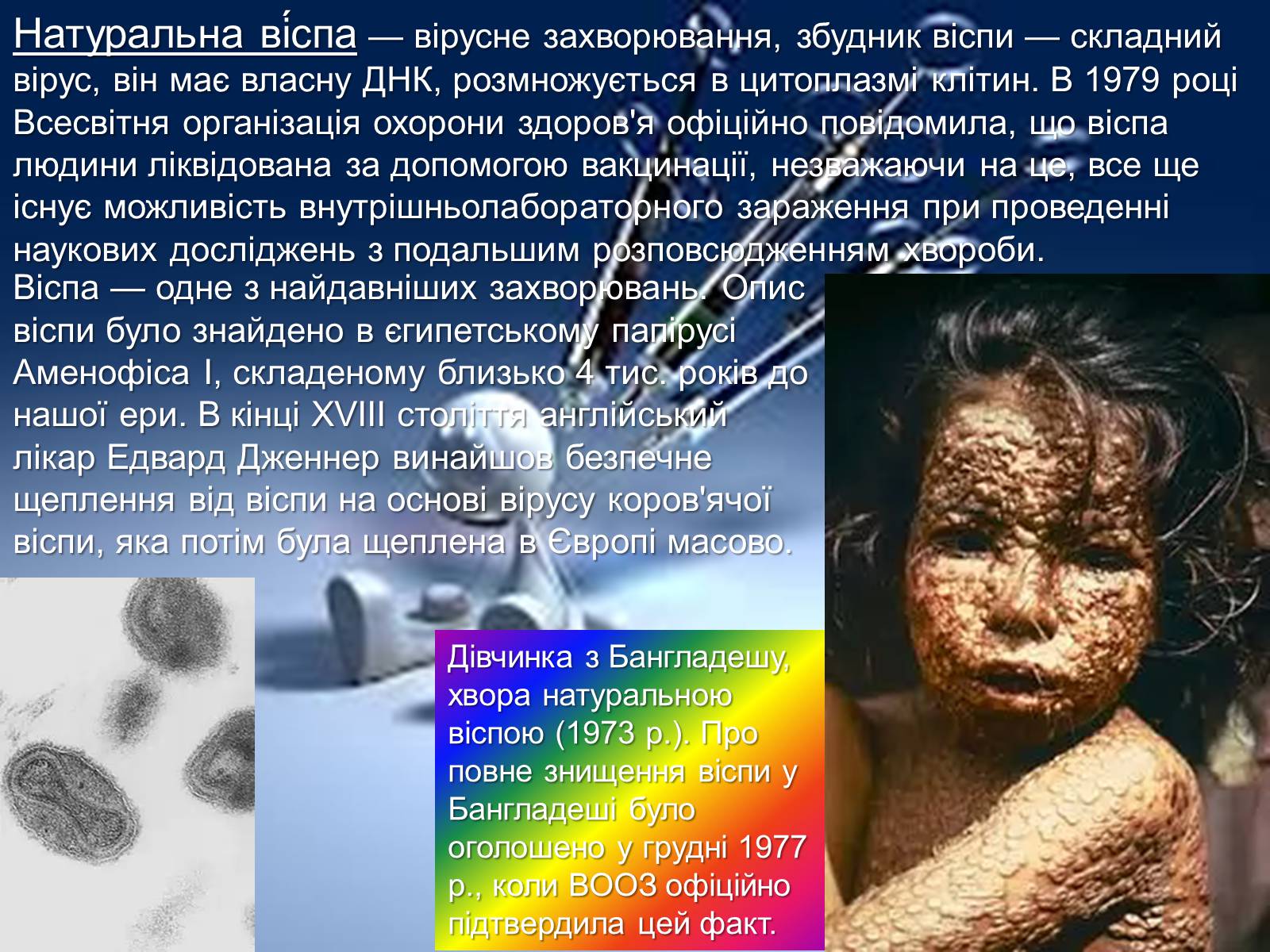 Презентація на тему «Інфекції» (варіант 1) - Слайд #25 Презентація на тему «Інфекції» (варіант 1) - Слайд #25