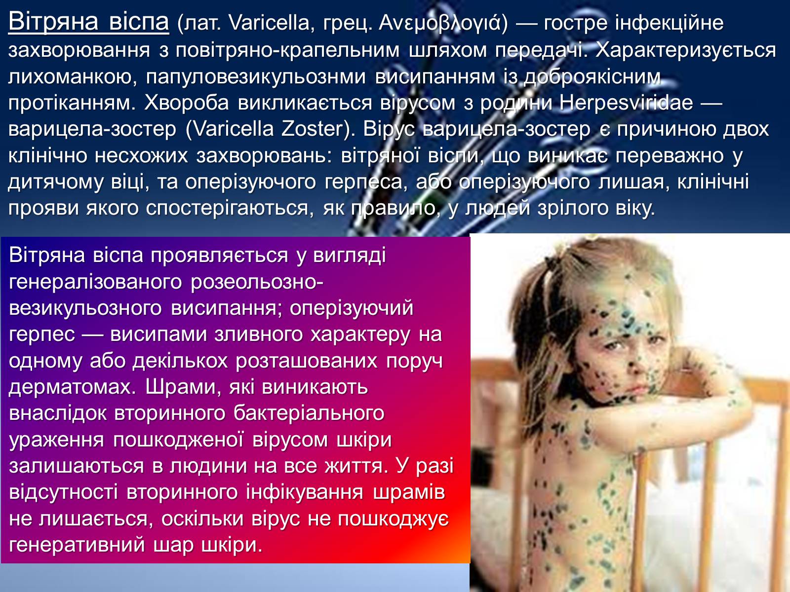 Презентація на тему «Інфекції» (варіант 1) - Слайд #26 Презентація на тему «Інфекції» (варіант 1) - Слайд #26