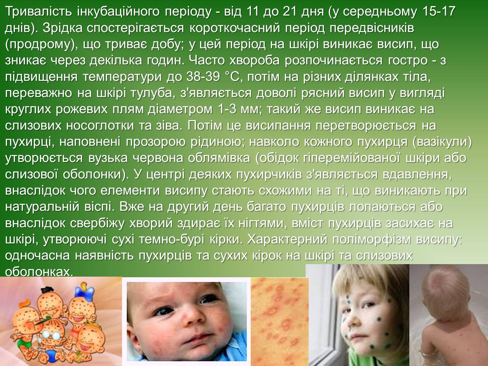 Презентація на тему «Інфекції» (варіант 1) - Слайд #27 Презентація на тему «Інфекції» (варіант 1) - Слайд #27