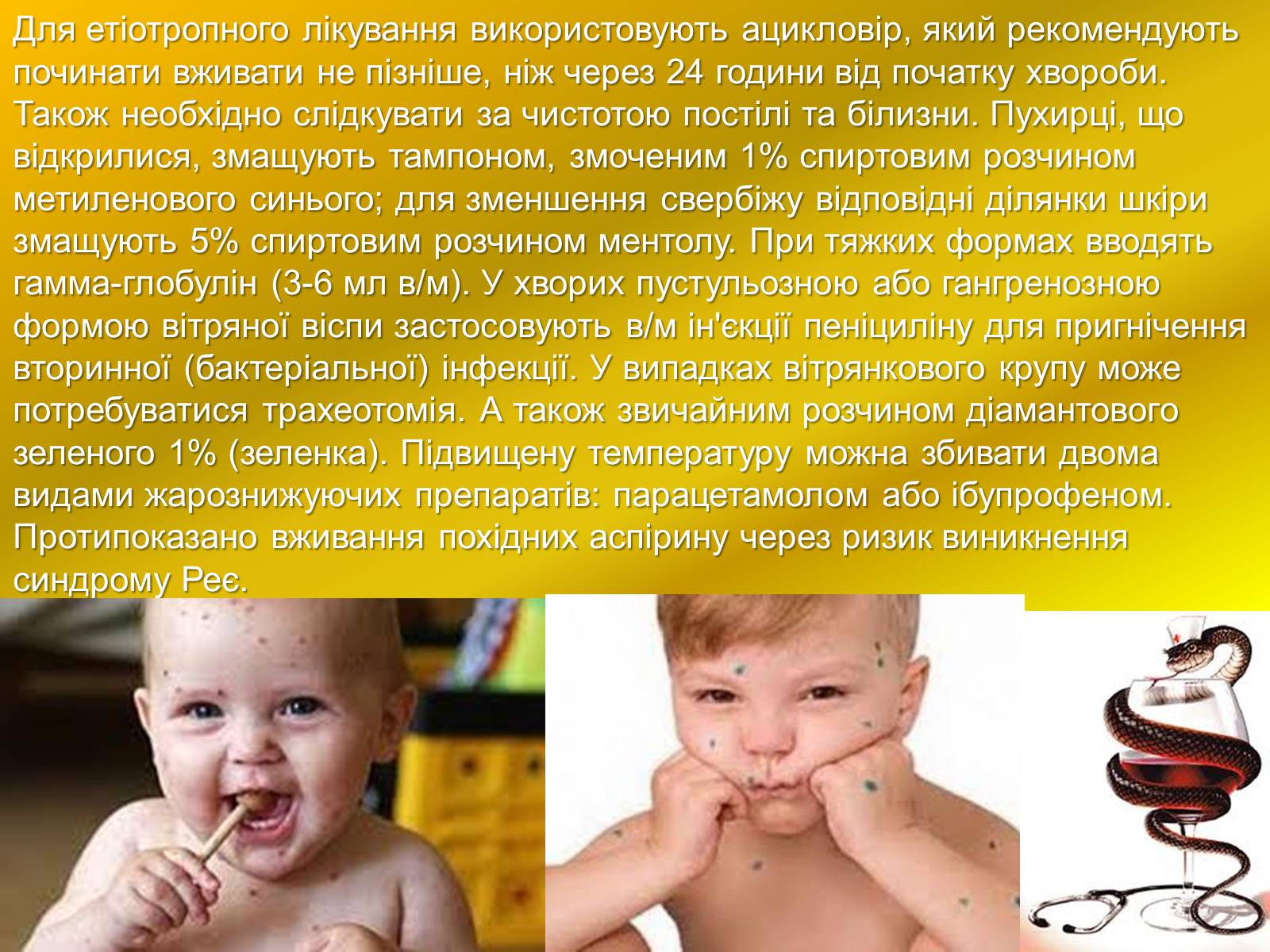 Презентація на тему «Інфекції» (варіант 1) - Слайд #28 Презентація на тему «Інфекції» (варіант 1) - Слайд #28