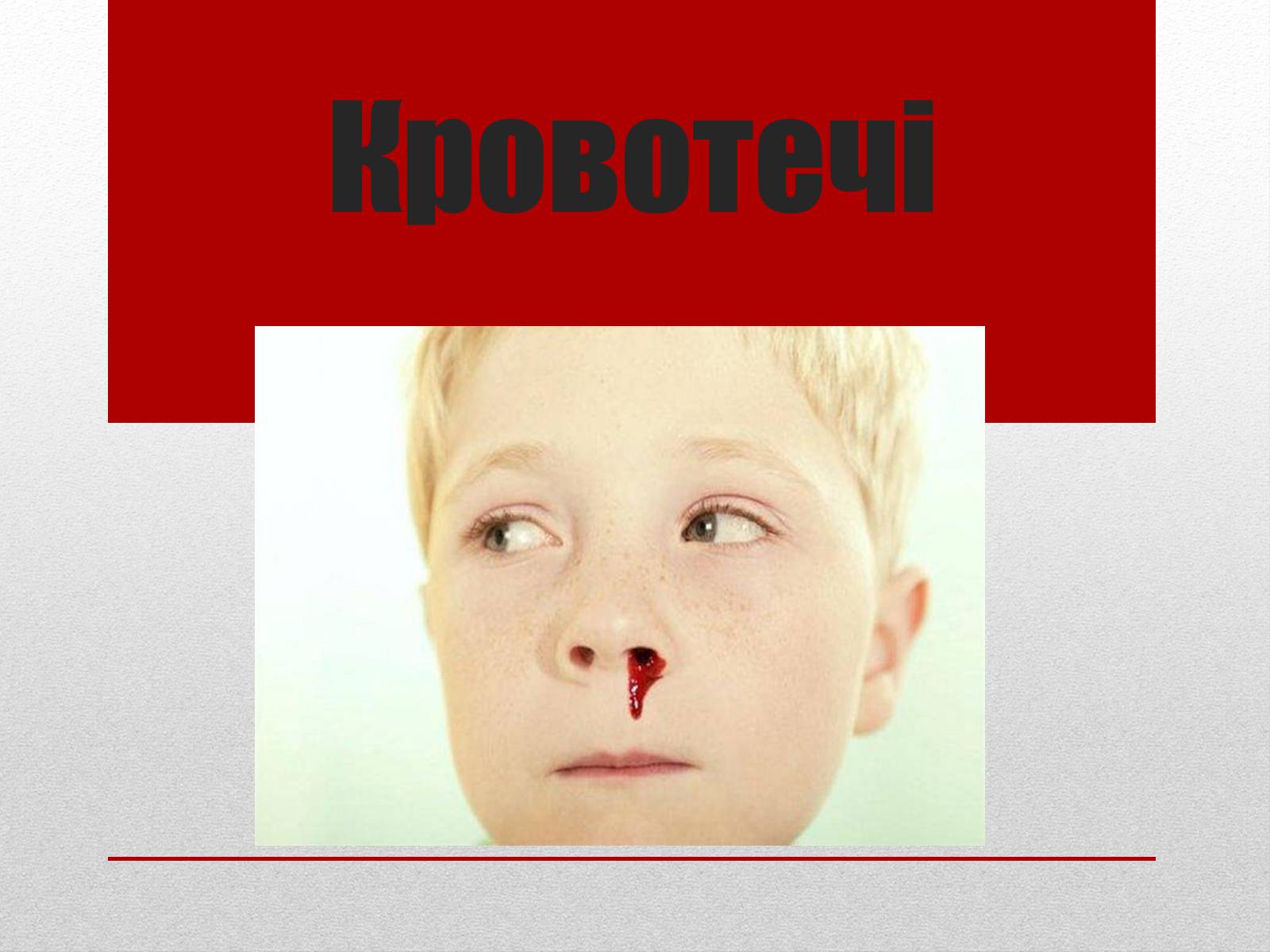 Презентація на тему «Кровотечі» (варіант 1) - Слайд #1 Презентація на тему «Кровотечі» (варіант 1) - Слайд #1
