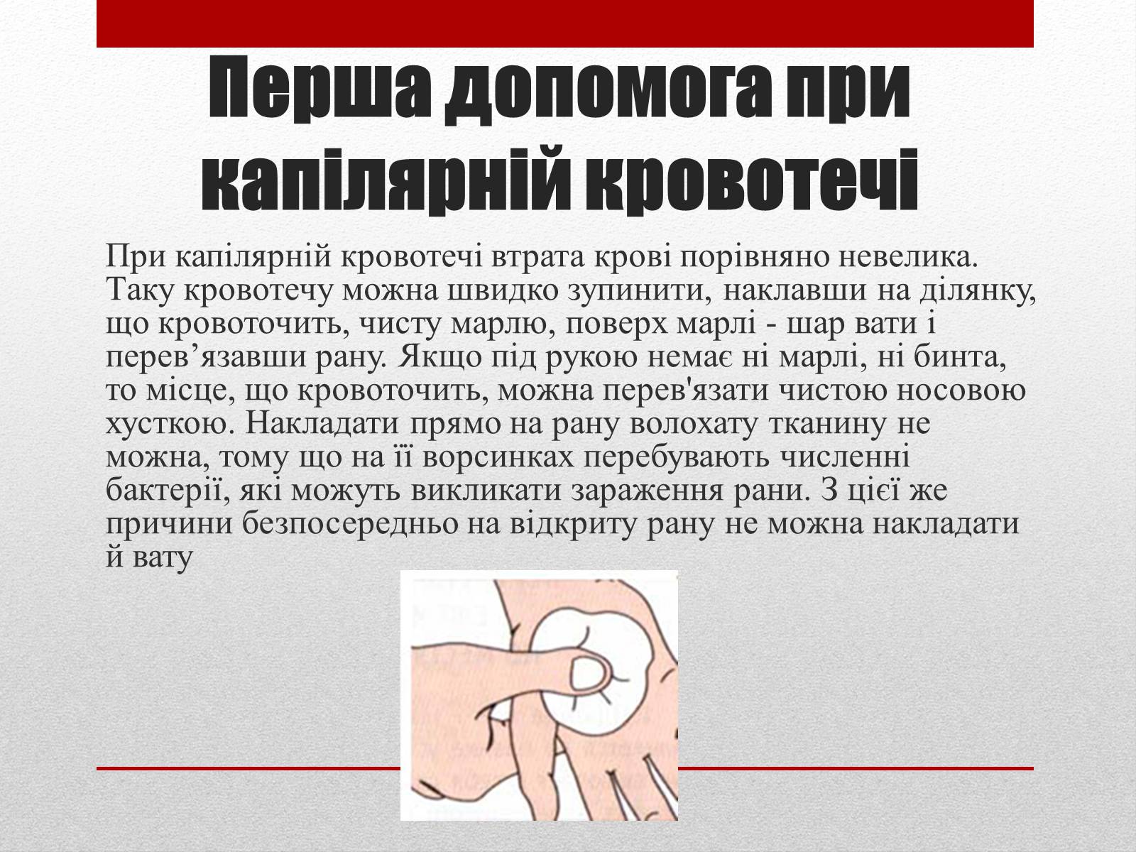 Презентація на тему «Кровотечі» (варіант 1) - Слайд #10 Презентація на тему «Кровотечі» (варіант 1) - Слайд #10