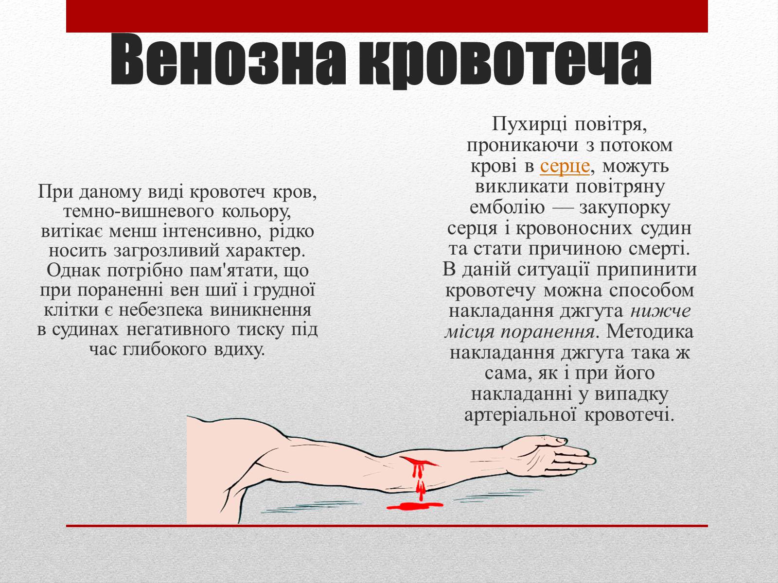 Презентація на тему «Кровотечі» (варіант 1) - Слайд #4 Презентація на тему «Кровотечі» (варіант 1) - Слайд #4