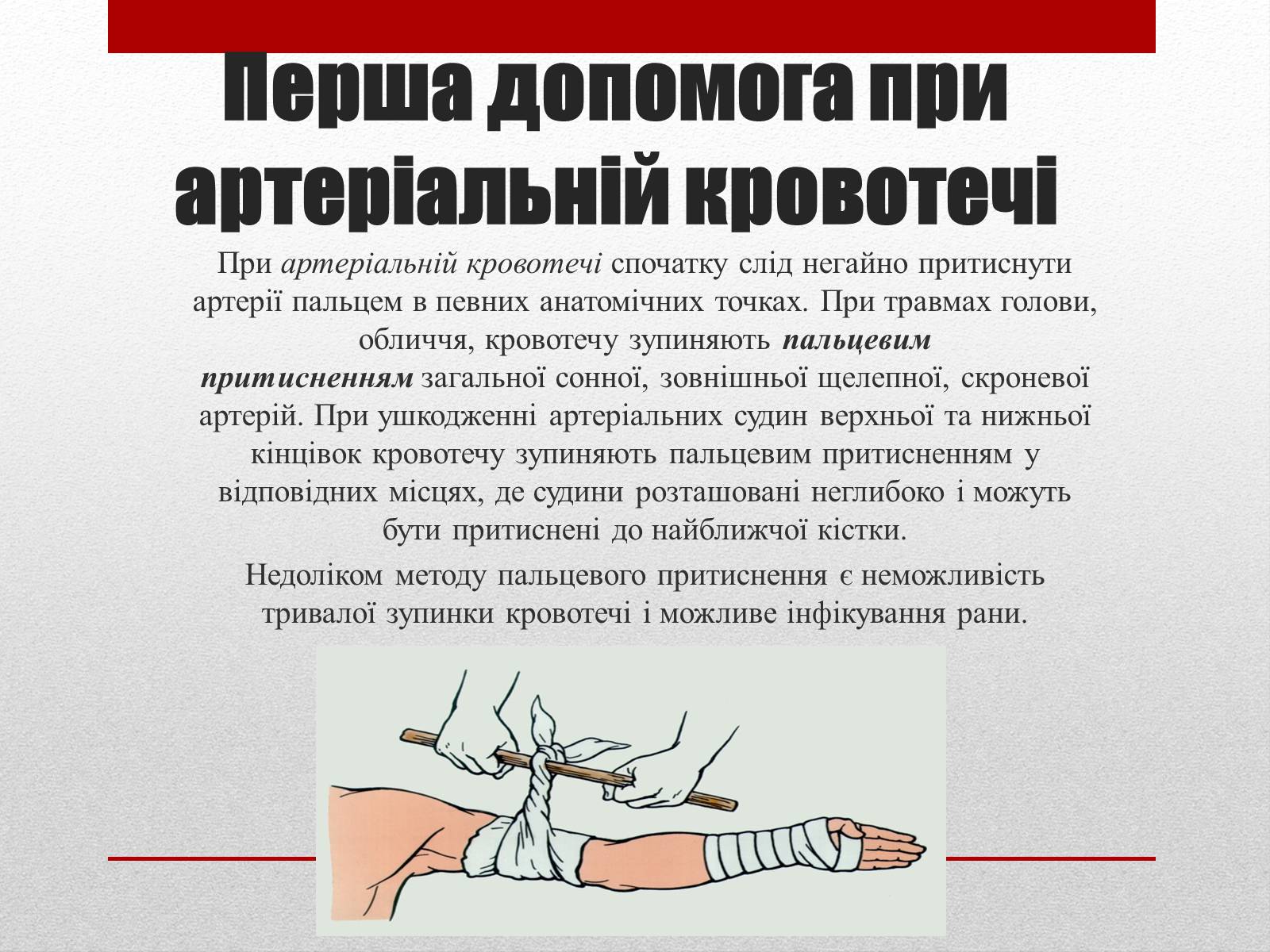 Презентація на тему «Кровотечі» (варіант 1) - Слайд #8 Презентація на тему «Кровотечі» (варіант 1) - Слайд #8