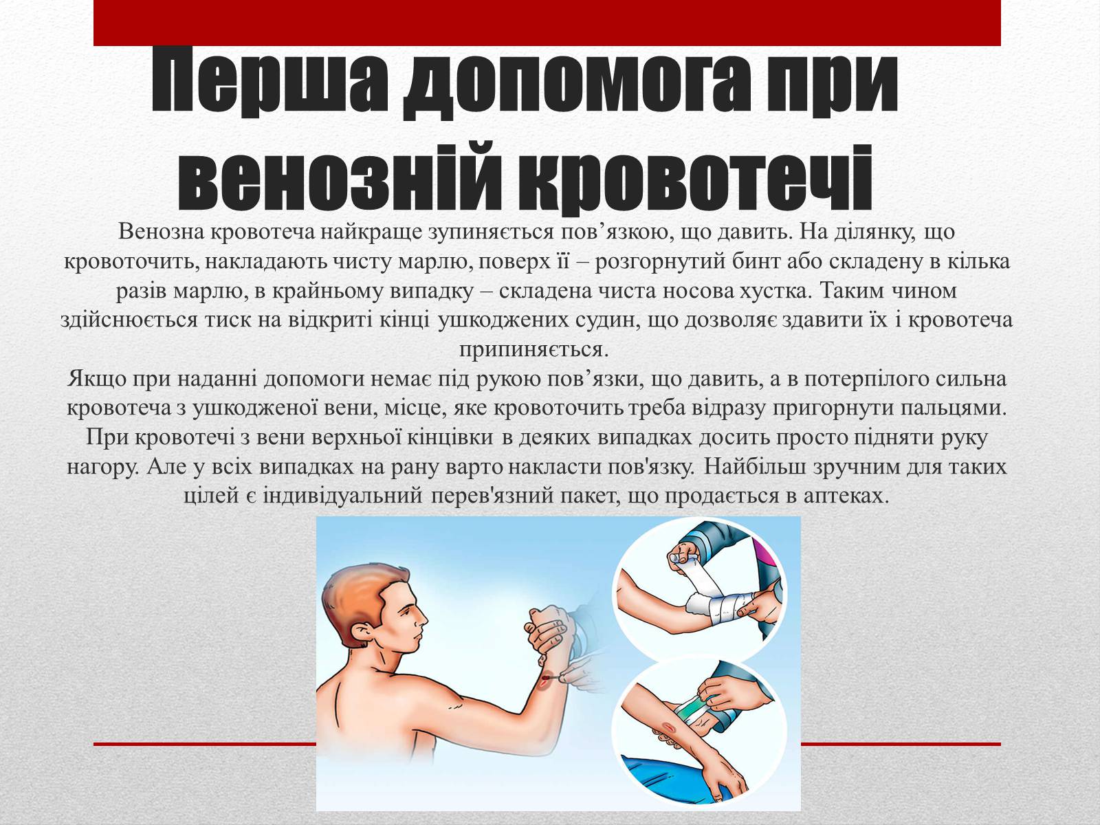 Презентація на тему «Кровотечі» (варіант 1) - Слайд #9 Презентація на тему «Кровотечі» (варіант 1) - Слайд #9