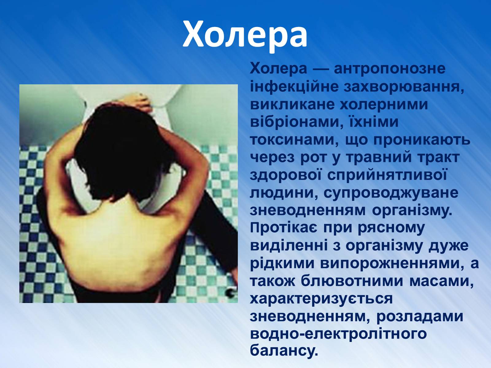 Презентація на тему «Захворювання травної системи» (варіант 1) - Слайд #12 Презентація на тему «Захворювання травної системи» (варіант 1) - Слайд #12