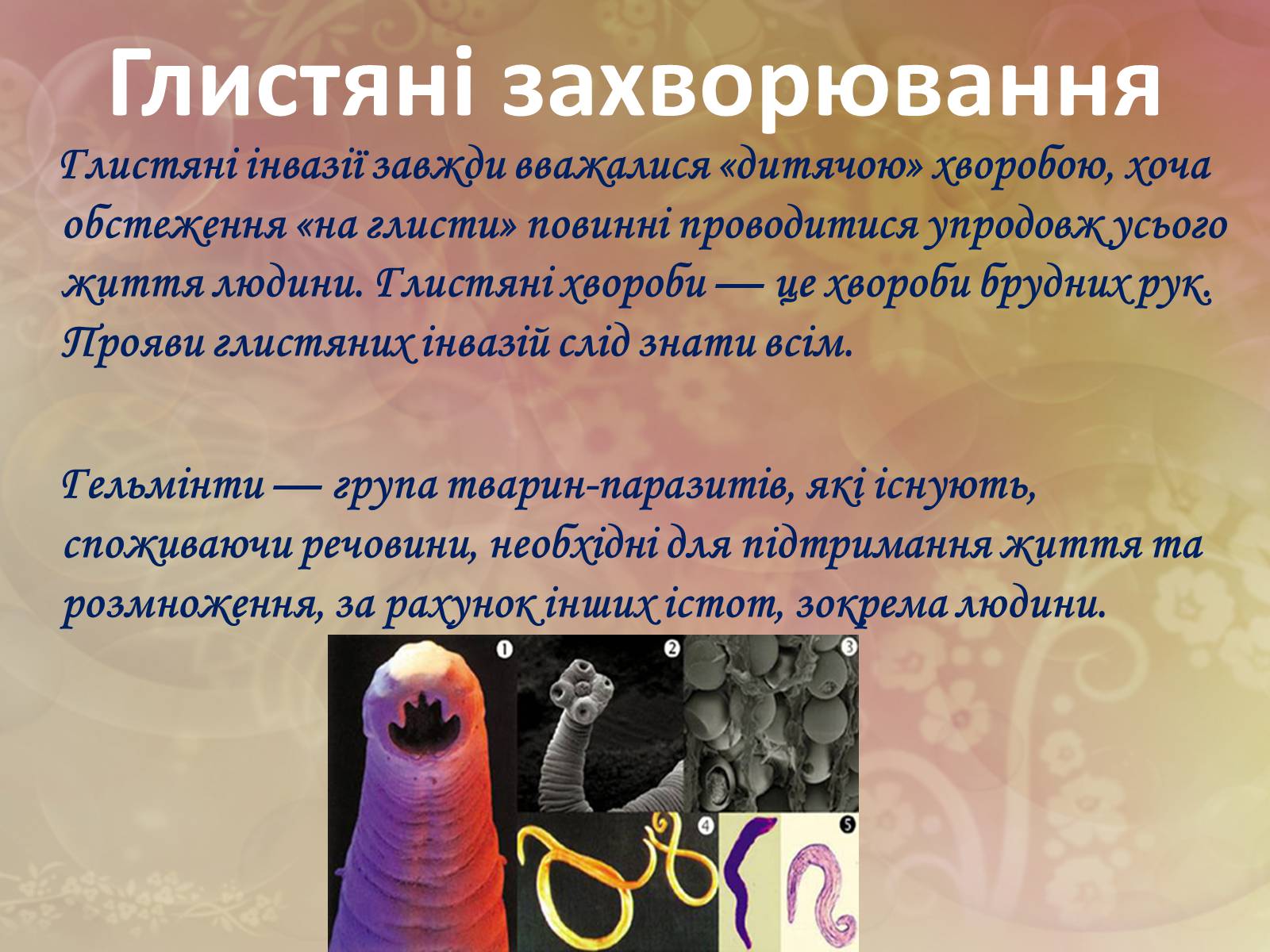 Презентація на тему «Захворювання травної системи» (варіант 1) - Слайд #17 Презентація на тему «Захворювання травної системи» (варіант 1) - Слайд #17