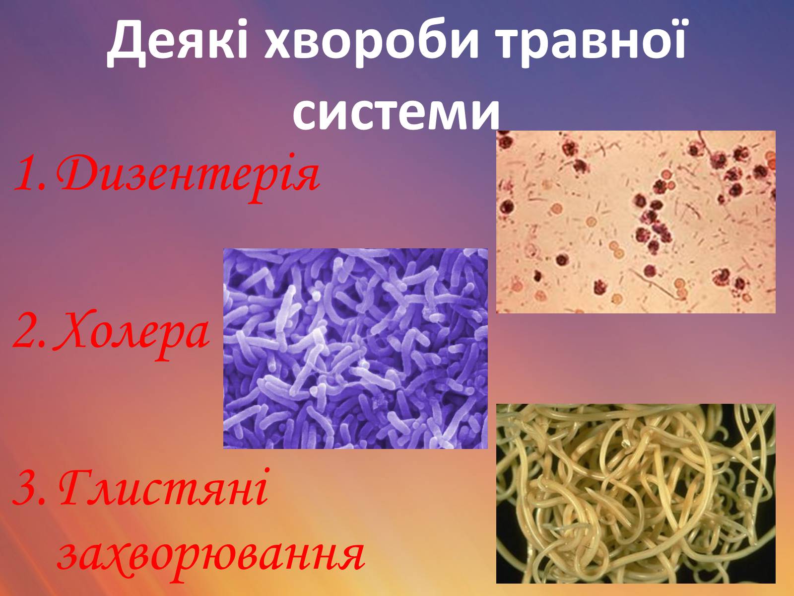 Презентація на тему «Захворювання травної системи» (варіант 1) - Слайд #6 Презентація на тему «Захворювання травної системи» (варіант 1) - Слайд #6