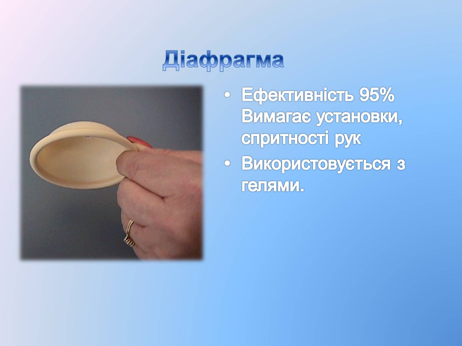 Презентація на тему «Контрацепція» (варіант 3) - Слайд #10 Презентація на тему «Контрацепція» (варіант 3) - Слайд #10