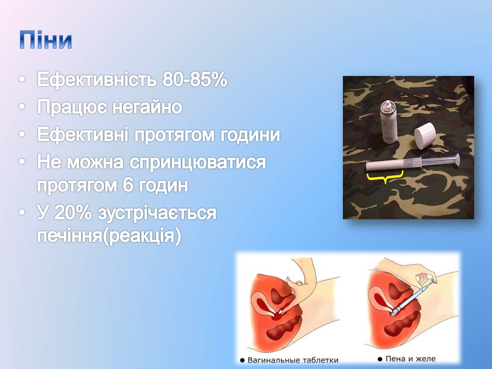 Презентація на тему «Контрацепція» (варіант 3) - Слайд #13 Презентація на тему «Контрацепція» (варіант 3) - Слайд #13