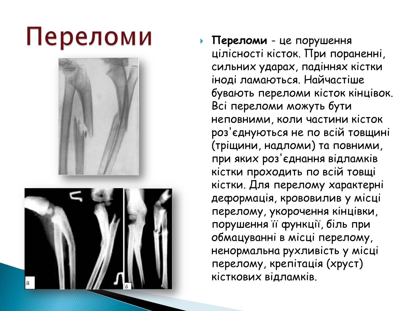 Презентація на тему «Травма систем організму» (варіант 2) - Слайд #13 Презентація на тему «Травма систем організму» (варіант 2) - Слайд #13