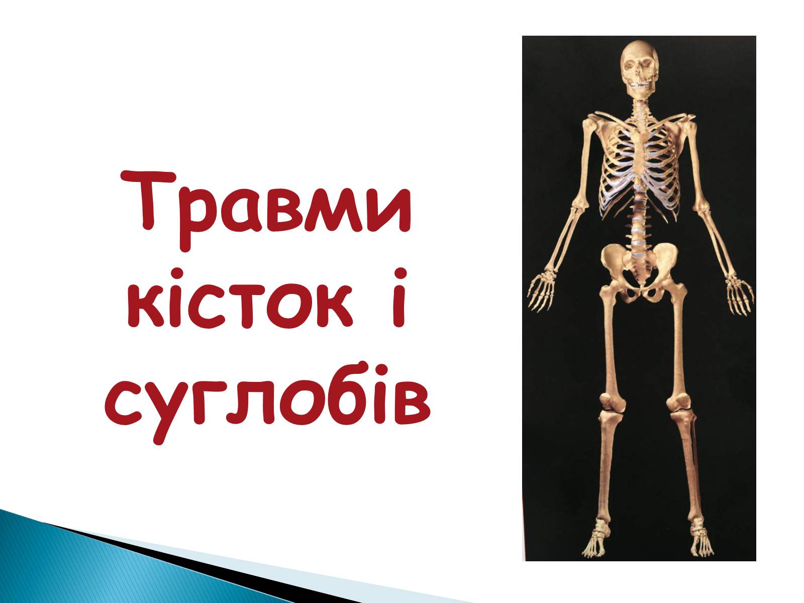 Презентація на тему «Травма систем організму» (варіант 2) - Слайд #8 Презентація на тему «Травма систем організму» (варіант 2) - Слайд #8