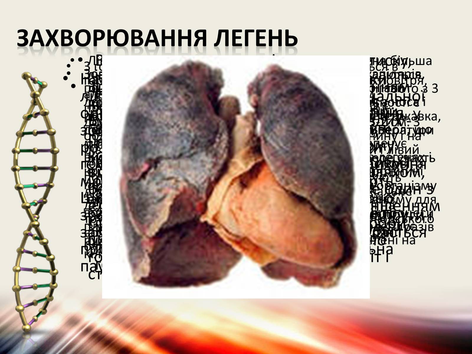 Презентація на тему «Захворювання дихальної системи» (варіант 1) - Слайд #17 Презентація на тему «Захворювання дихальної системи» (варіант 1) - Слайд #17