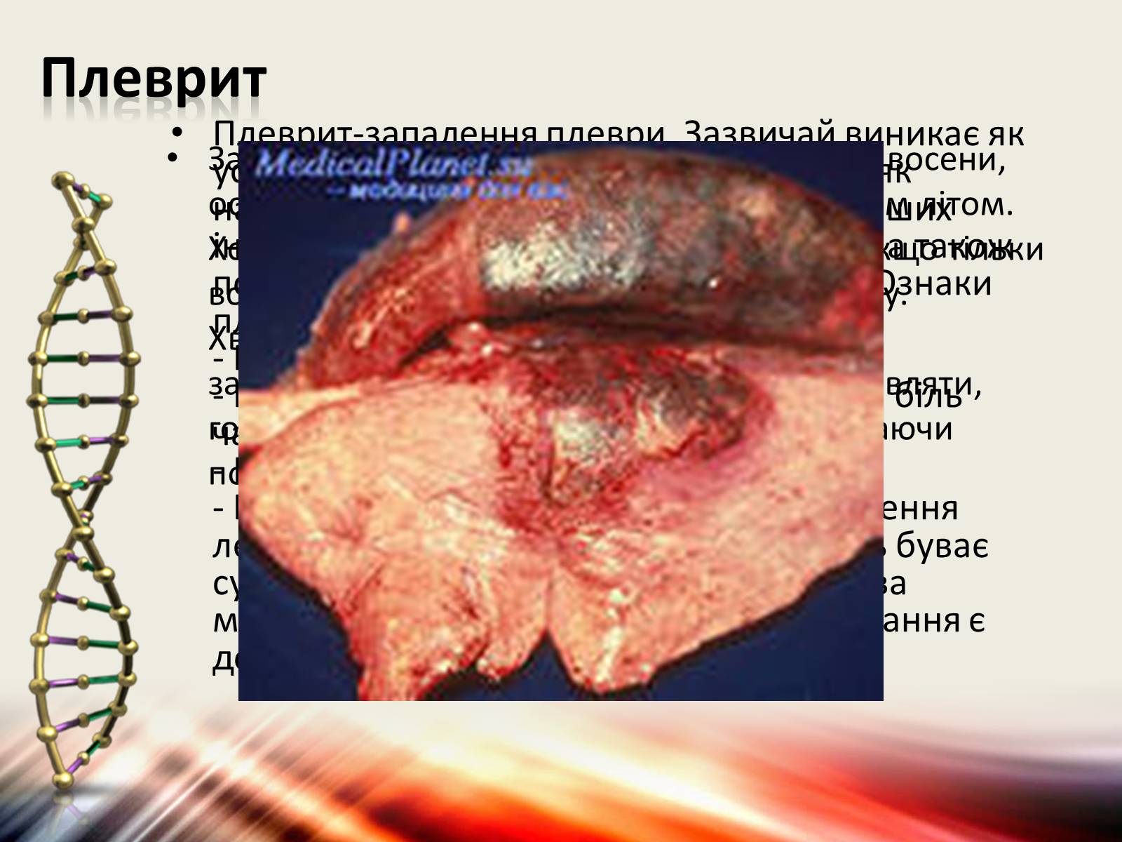 Презентація на тему «Захворювання дихальної системи» (варіант 1) - Слайд #19 Презентація на тему «Захворювання дихальної системи» (варіант 1) - Слайд #19