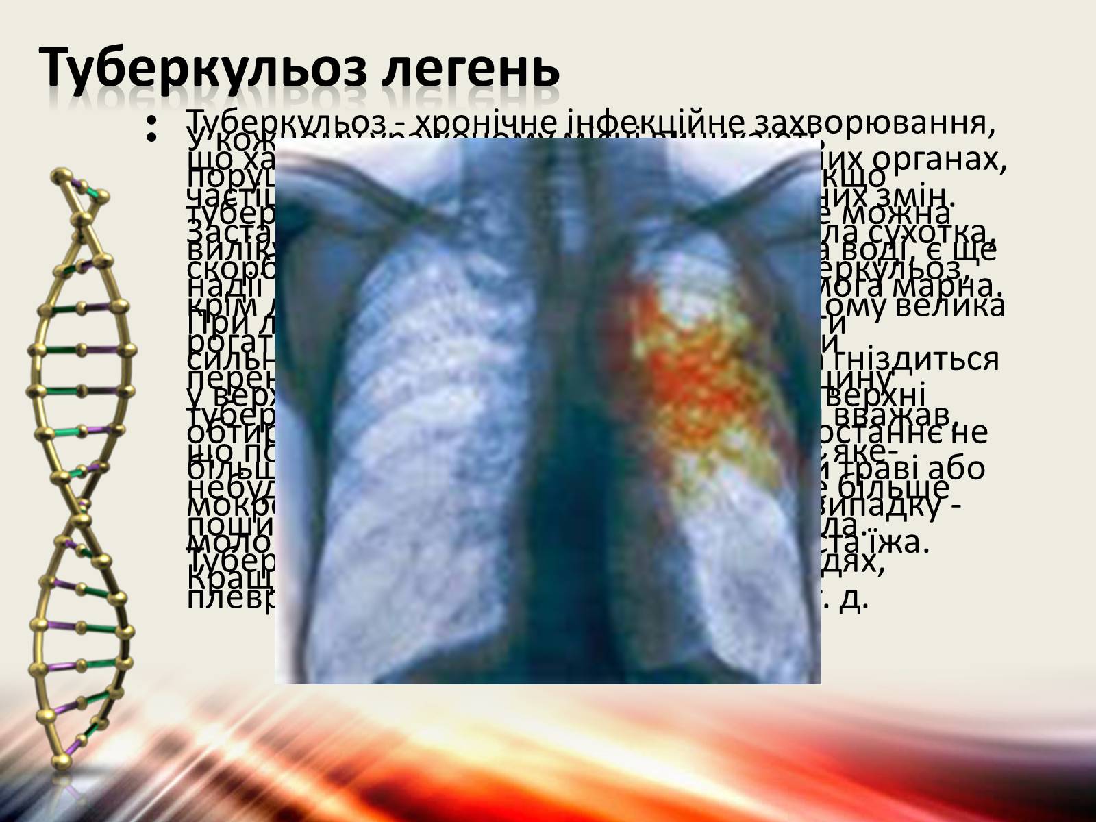 Презентація на тему «Захворювання дихальної системи» (варіант 1) - Слайд #20 Презентація на тему «Захворювання дихальної системи» (варіант 1) - Слайд #20