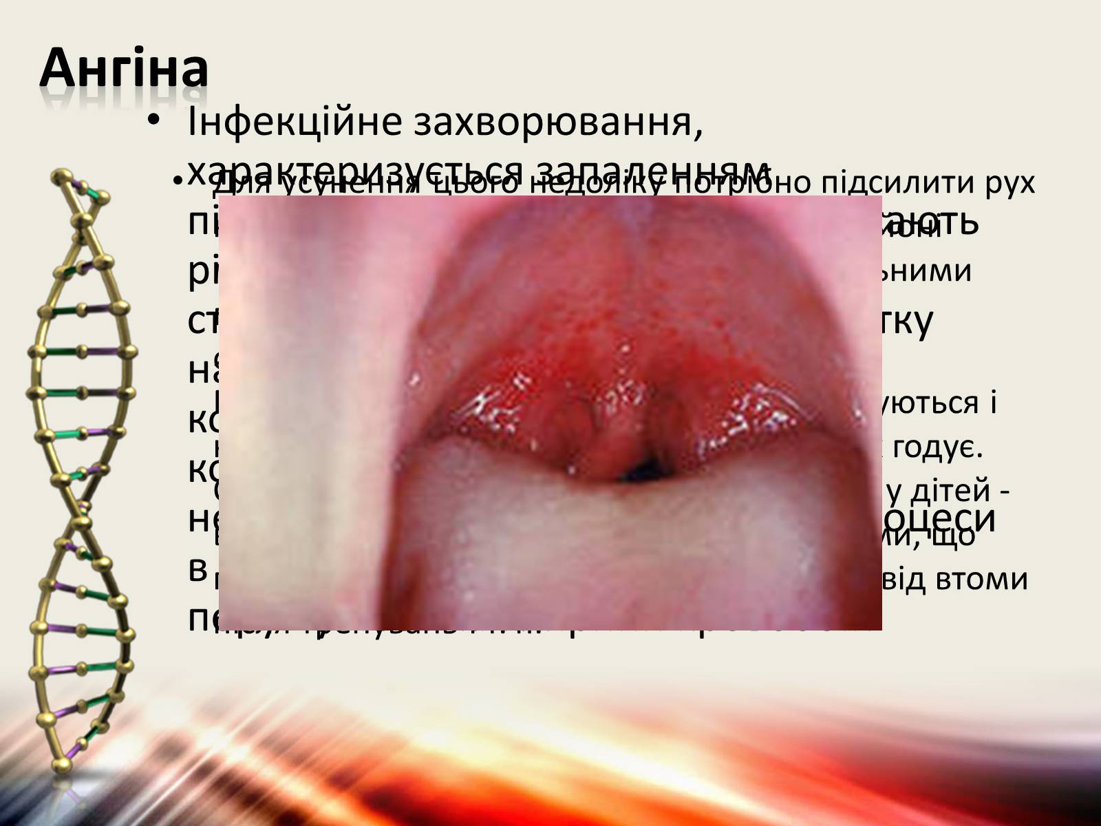 Презентація на тему «Захворювання дихальної системи» (варіант 1) - Слайд #6 Презентація на тему «Захворювання дихальної системи» (варіант 1) - Слайд #6